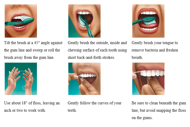 Jackosnville Emergency Dentist Toothbrush Techniques 