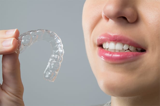 Invisalign